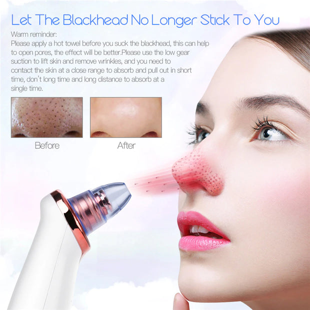 Ckeyin Electric Blackhead Remover Vacuum Facial Acne Cleaner Pimple Pore Cleansing Device Black Nose Point Beauty Skin Care Tool