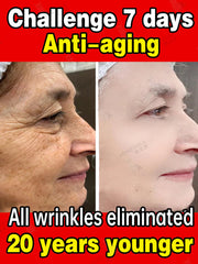 Effective Anti-Ageing and Anti-Wrinkle Facial Serum to Remove Facial Wrinkles Fine Lines around the Eyes Crow'S Feet Neck Wrinkl