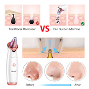 Ckeyin Electric Blackhead Remover Vacuum Facial Acne Cleaner Pimple Pore Cleansing Device Black Nose Point Beauty Skin Care Tool